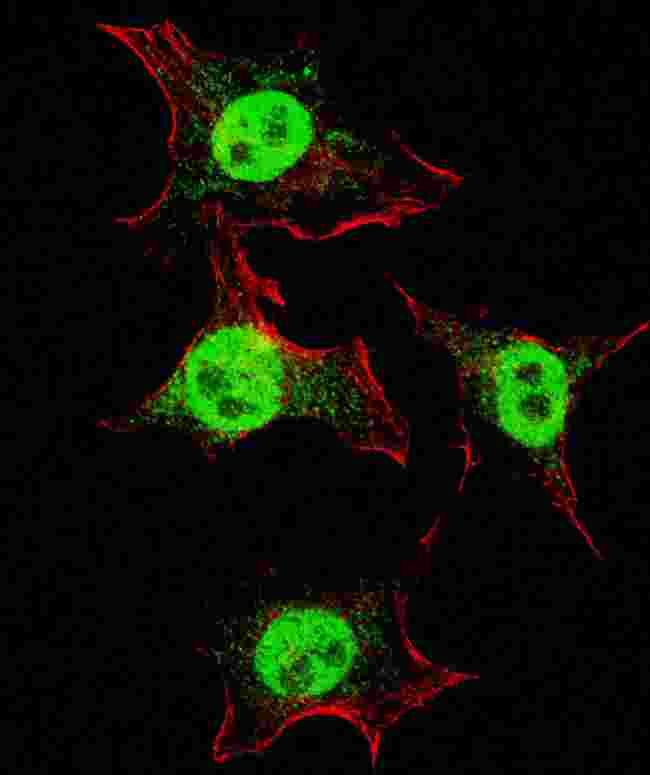 ITGA6/Integrin Alpha 6/CD49f Antibody - Fluorescent confocal image of HeLa cells stained with ITGA6 (isoform 2 S1064) antibody. HeLa cells were fixed with 4% PFA (20 min), permeabilized with Triton X-100 (0.2%, 30 min). Cells were then incubated ITGA6 (isoform 2 S1064) primary antibody (1:200, 2 h at room temperature). For secondary antibody, Alexa Fluor 488 conjugated donkey anti-rabbit antibody (green) was used (1:1000, 1h). Nuclei were counterstained with Hoechst 33342 (blue) (10 ug/ml, 5 min). Note the highly specific localization of the ITGA6 mainly to the nucleus, supported by Human Protein Atlas Data (http://www.proteinatlas.org/ENSG00000091409).