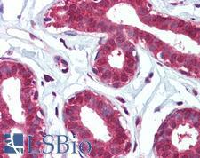 ITGA6/Integrin Alpha 6/CD49f Antibody - Anti-ITGA6 / CD49f antibody IHC of human breast. Immunohistochemistry of formalin-fixed, paraffin-embedded tissue after heat-induced antigen retrieval. Antibody concentration 5 ug/ml.