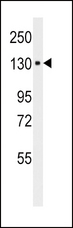 ITGA6/Integrin Alpha 6/CD49f Antibody - Western blot of anti-ITA6 in HepG2 cell line lysates (35 ug/lane). ITA6 (arrow) was detected using the purified antibody.(8 ug/ml)