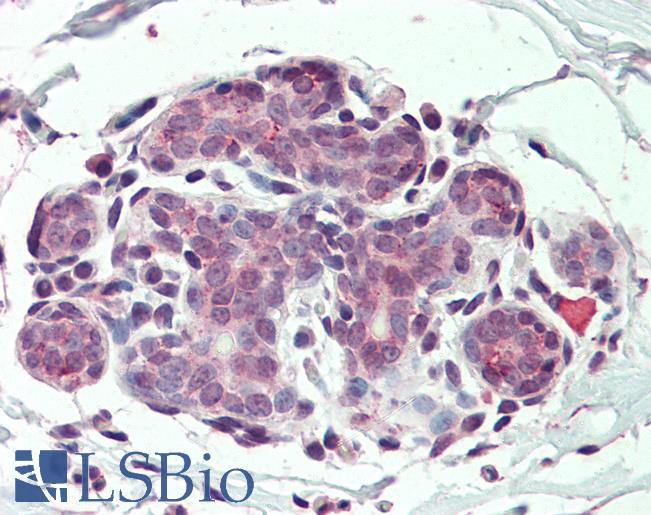 ITGA6/Integrin Alpha 6/CD49f Antibody - Anti-ITGA6 / CD49f antibody IHC of human breast. Immunohistochemistry of formalin-fixed, paraffin-embedded tissue after heat-induced antigen retrieval.
