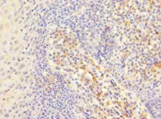 ITGAE / CD103 Antibody - Immunohistochemistry of paraffin-embedded human tonsil tissue at dilution 1:100