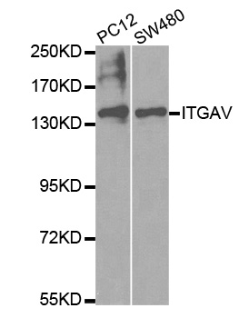 ITGAV/Integrin Alpha V/CD51 Antibody - Western blot analysis of extracts of various cell lines, using ITGAV antibody.