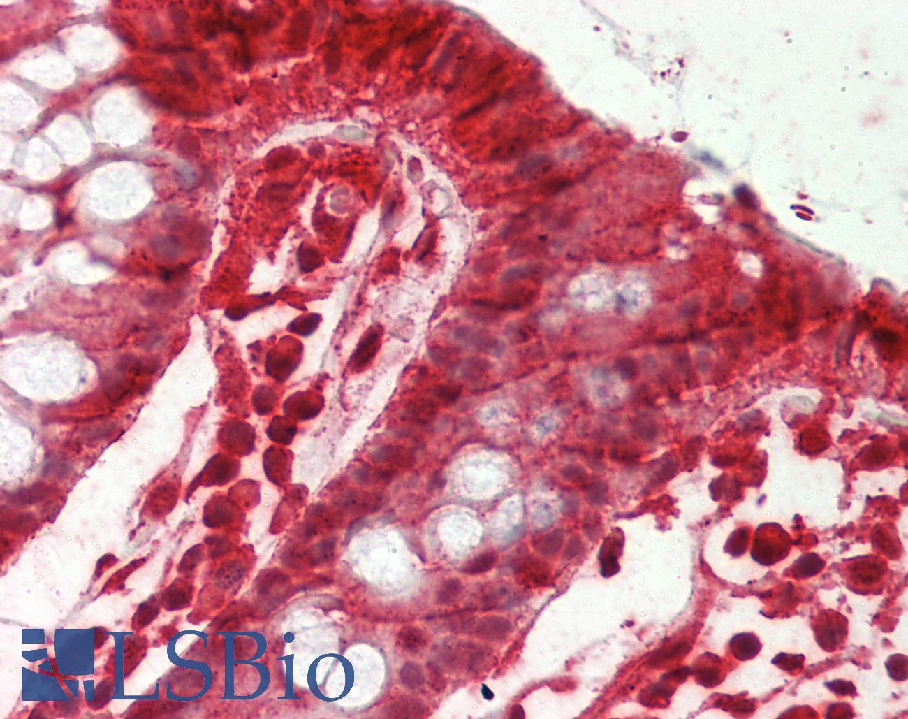 ITGB1 / Integrin Beta 1 / CD29 Antibody - Human Colon: Formalin-Fixed, Paraffin-Embedded (FFPE)