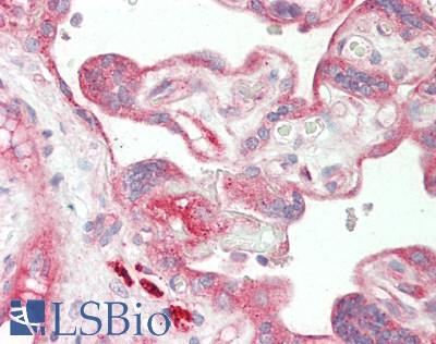 ITGB1 / Integrin Beta 1 / CD29 Antibody - Human Placenta: Formalin-Fixed, Paraffin-Embedded (FFPE)