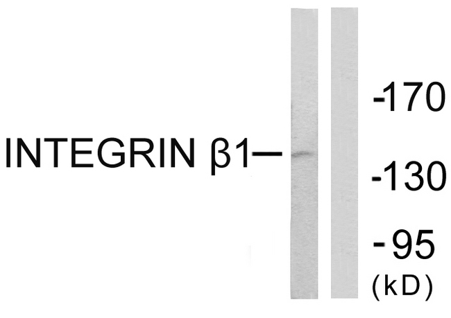 ITGB1 / Integrin Beta 1 / CD29 Antibody - Western blot analysis of lysates from Jurkat cells, using Integrin beta1 Antibody. The lane on the right is blocked with the synthesized peptide.
