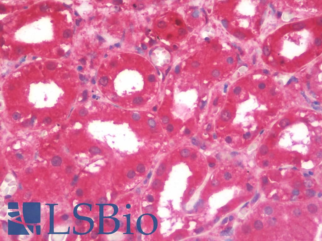 ITGB1 / Integrin Beta 1 / CD29 Antibody - Anti-ITGB1 / Integrin Beta 1 / CD29 antibody IHC staining of human kidney. Immunohistochemistry of formalin-fixed, paraffin-embedded tissue after heat-induced antigen retrieval. Antibody concentration 10 ug/ml. This image was taken for the unmodified form of this product. Other forms have not been tested.