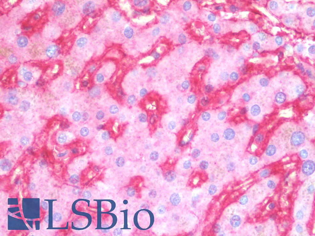 ITGB1 / Integrin Beta 1 / CD29 Antibody - Anti-ITGB1 / Integrin Beta 1 / CD29 antibody IHC staining of human liver. Immunohistochemistry of formalin-fixed, paraffin-embedded tissue after heat-induced antigen retrieval. This image was taken for the unmodified form of this product. Other forms have not been tested.