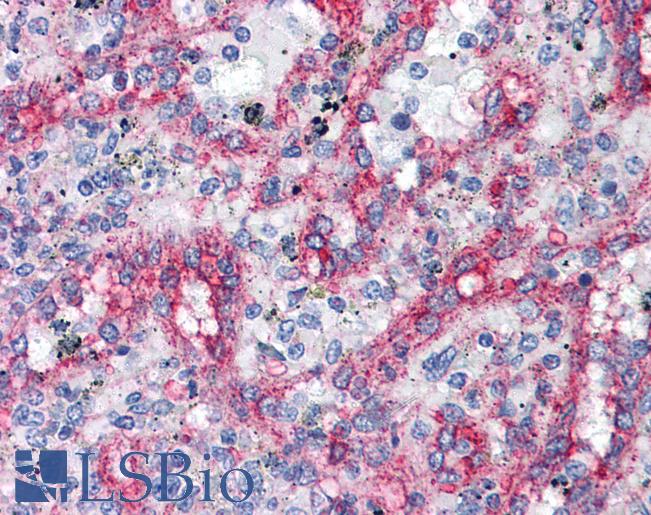 ITGB1 / Integrin Beta 1 / CD29 Antibody - Anti-Integrin Beta 1 antibody IHC of human spleen. Immunohistochemistry of formalin-fixed, paraffin-embedded tissue after heat-induced antigen retrieval. Antibody dilution 1:50. This image was taken for the unconjugated form of this product. Other forms have not been tested.