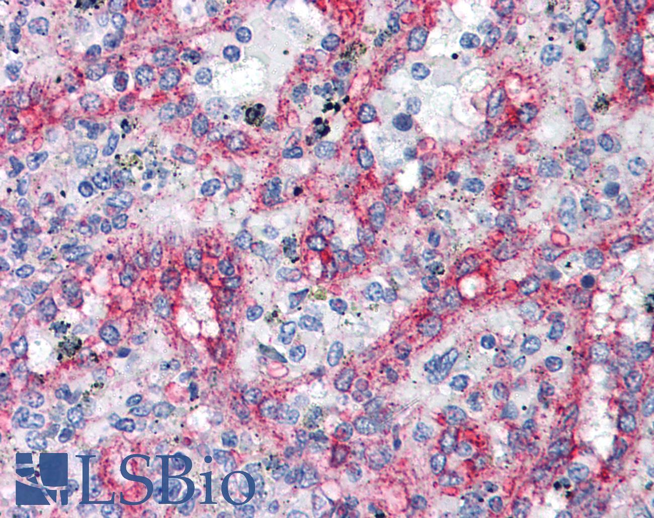 ITGB1 / Integrin Beta 1 / CD29 Antibody - Anti-Integrin Beta 1 antibody IHC of human spleen. Immunohistochemistry of formalin-fixed, paraffin-embedded tissue after heat-induced antigen retrieval. Antibody dilution 1:50. This image was taken for the unconjugated form of this product. Other forms have not been tested.