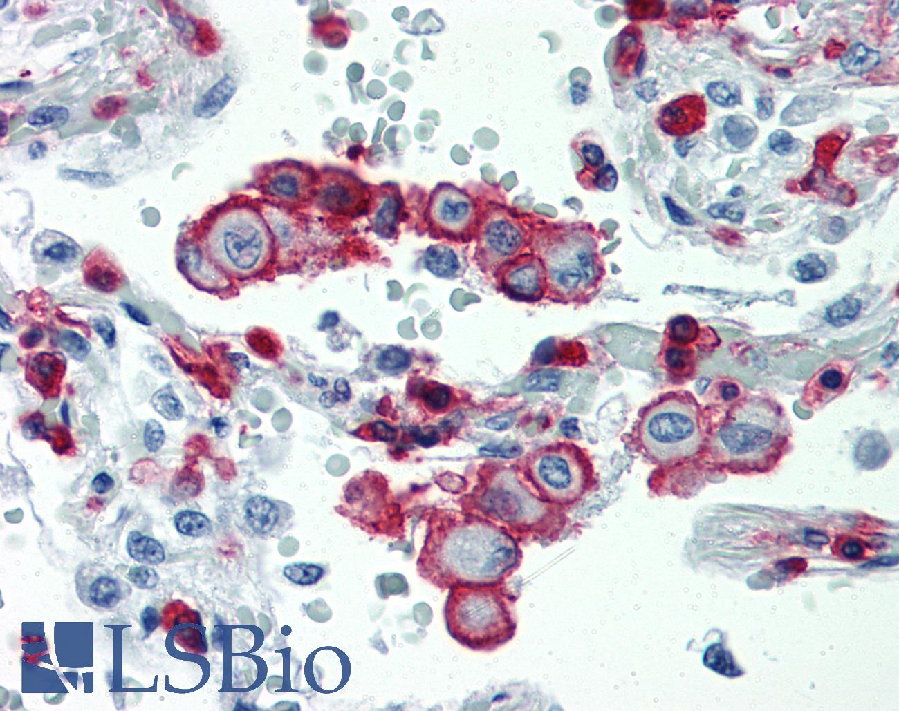 ITGB2 / CD18 Antibody - Anti-ITGB2 / CD18 antibody IHC staining of human lung. Immunohistochemistry of formalin-fixed, paraffin-embedded tissue after heat-induced antigen retrieval. Antibody concentration 10 ug/ml.