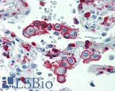 ITGB2 / CD18 Antibody - Anti-ITGB2 / CD18 antibody IHC staining of human lung. Immunohistochemistry of formalin-fixed, paraffin-embedded tissue after heat-induced antigen retrieval. Antibody concentration 10 ug/ml.