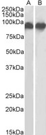 ITGB2 / CD18 Antibody - Goat anti-ITGB2 / LFA-1 (aa86-99) Antibody (0.3µg/ml) staining of K562 (A) and U937 (B) lysates (35µg protein in RIPA buffer). Primary incubation was 1 hour. Detected by chemiluminescencence.