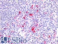 ITGB2 / CD18 Antibody - Human Spleen: Formalin-Fixed, Paraffin-Embedded (FFPE)