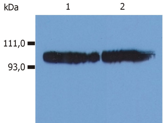 ITGB2 / CD18 Antibody - Western Blotting analysis (non-reducing conditions) of whole cell lysate using anti-human CD18 (MEM-48).  Lane 1: KG-1a human acute myeloid leukemia cell line  Lane 2: HPB-ALL human peripheral blood T cell leukemia cell line