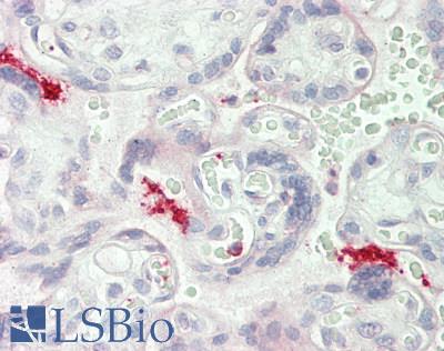 ITGB3 / Integrin Beta 3 / CD61 Antibody - Human Placenta: Formalin-Fixed, Paraffin-Embedded (FFPE)