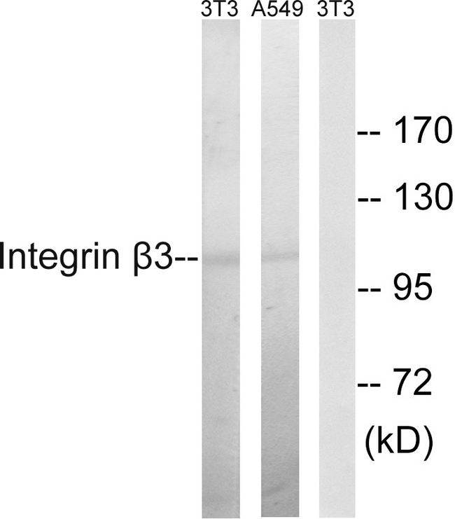 ITGB3 / Integrin Beta 3 / CD61 Antibody - Western blot analysis of lysates from NIH/3T3 and A549 cells, using Integrin beta3 Antibody. The lane on the right is blocked with the synthesized peptide.