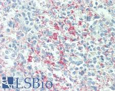 ITGB3 / Integrin Beta 3 / CD61 Antibody - Human Spleen: Formalin-Fixed, Paraffin-Embedded (FFPE)