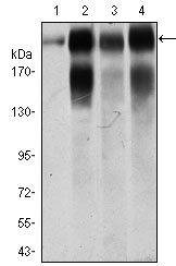 ITGB4 / Integrin Beta 4 Antibody - Western blot using ITGB4 mouse monoclonal antibody against A549 (1), A431 (2), MCF-7 (3) and SW620 (4) cell lysate.