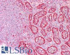 ITGB7 / Integrin Beta 7 Antibody - Human Spleen: Formalin-Fixed, Paraffin-Embedded (FFPE)