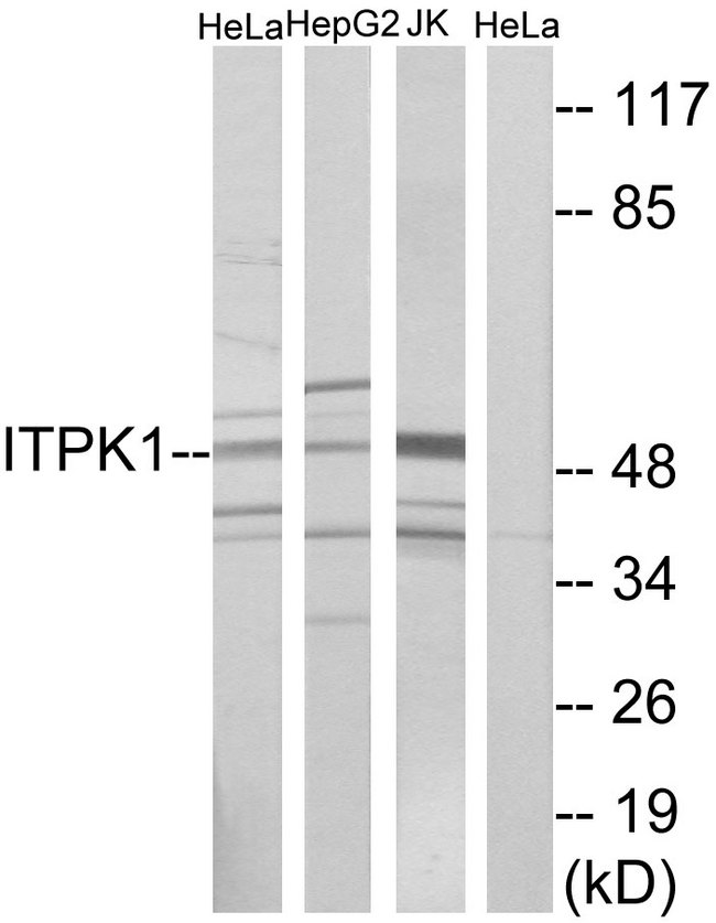 ITPK1 Antibody - Western blot analysis of lysates from HeLa, HepG2, and Jurkat cells, using ITPK1 Antibody. The lane on the right is blocked with the synthesized peptide.