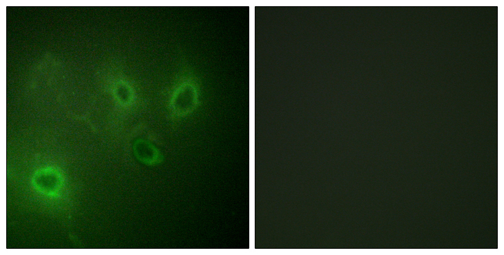 ITPR1 / IP3 Receptor Type 1 Antibody - Immunofluorescence analysis of COS7 cells, using InsP3R1 Antibody. The picture on the right is blocked with the synthesized peptide.