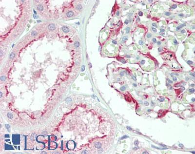 ITPR3 Antibody - Human Kidney: Formalin-Fixed, Paraffin-Embedded (FFPE), at a concentration of 5 ug/ml. 