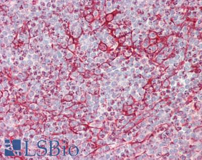 ITPR3 Antibody - Human Tonsil: Formalin-Fixed, Paraffin-Embedded (FFPE), at a concentration of 5 ug/ml. 