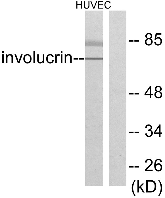 IVL / Involucrin Antibody - Western blot analysis of lysates from HUVEC cells, using Involucrin Antibody. The lane on the right is blocked with the synthesized peptide.