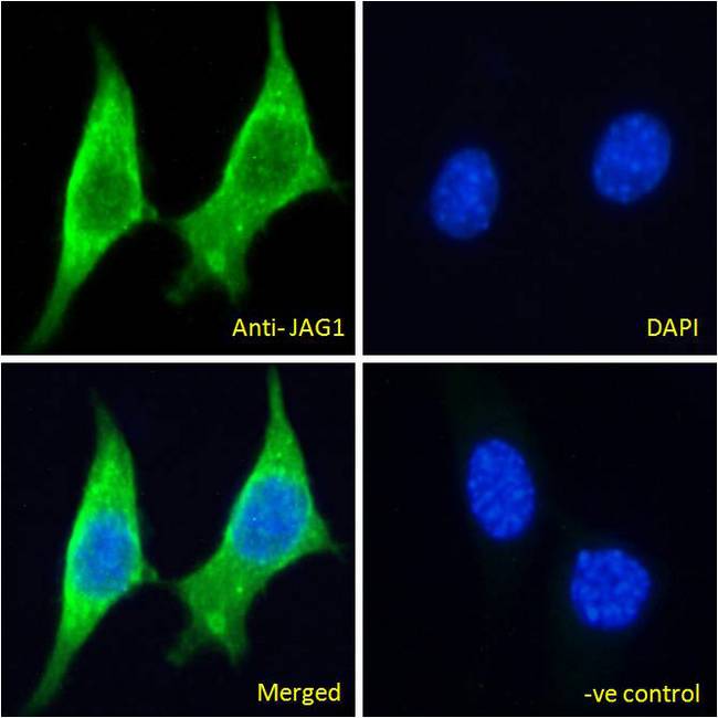 JAG1 / Jagged 1 Antibody - JAG1 / Jagged 1 antibody immunofluorescence analysis of paraformaldehyde fixed NIH3T3 cells, permeabilized with 0.15% Triton. Primary incubation 1hr (5ug/ml) followed by Alexa Fluor 488 secondary antibody (2ug/ml), showing cytoplasmic staining. The nuclear stain is DAPI (blue). Negative control: Unimmunized goat IgG (10ug/ml) followed by Alexa Fluor 488 secondary antibody (2ug/ml).