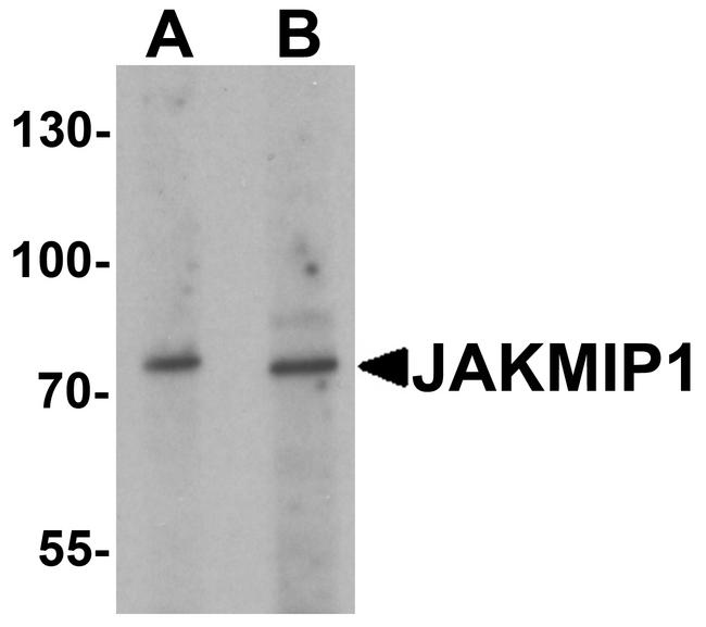JAKMIP1 Antibody - Western blot analysis of JAKMIP1 in rat brain tissue lysate with JAKMIP1 antibody at (A) 1 and (B) 2 ug/ml