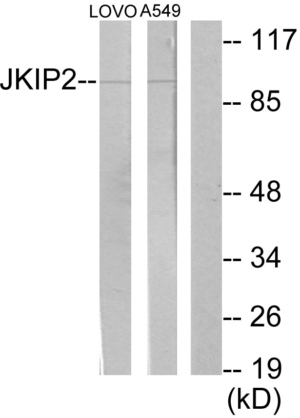 JAKMIP2 Antibody - Western blot analysis of lysates from LOVO and A549 cells, using JAKMIP2 Antibody. The lane on the right is blocked with the synthesized peptide.