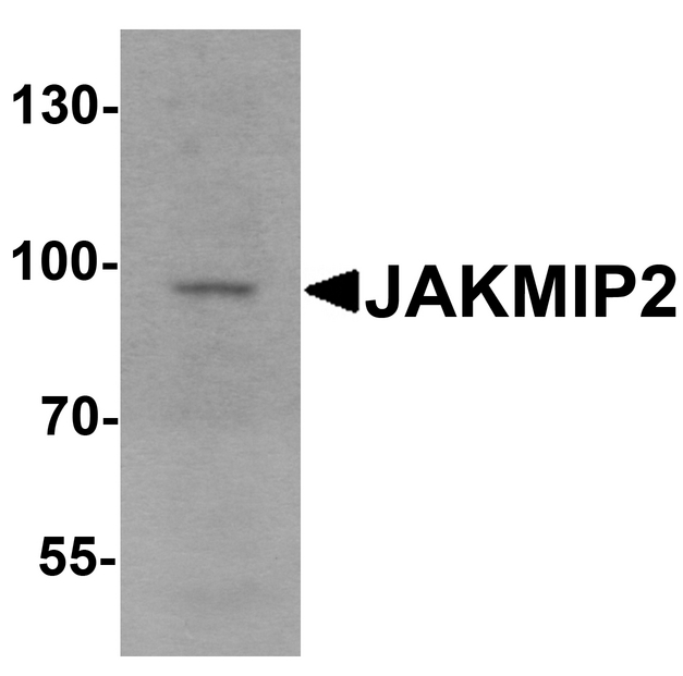JAKMIP2 Antibody - Western blot analysis of JAKMIP2 in mouse brain tissue lysate with JAKMIP2 antibody at 1 ug/ml.