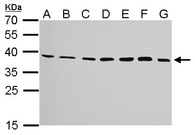 JAM2 Antibody - JAM-B antibody detects JAM2 protein by Western blot analysis. A. 30 ug Neuro2A whole cell lysate/extract. B. 30 ug GL261 whole cell lysate/extract. C. 30 ug C8D30 whole cell lysate/extract. D. 30 ug NIH-3T3 whole cell lysate/extract. E. 30 ug BCL-1 whole cell lysate/extract. F. 30 ug Raw264.7 whole cell lysate/extract. G. 30 ug C2C12 whole cell lysate/extract. 12 % SDS-PAGE. JAM-B antibody dilution:1:1000