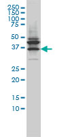 JAM2 Antibody - Western blot of JAM2 expression in LNCaP cells with JAM2 monoclonal antibody, clone 1G4.