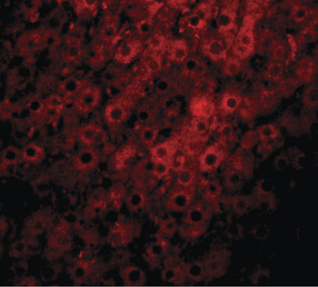 JMJD1C Antibody - Immunofluorescence of JMJD1C in rat liver tissue with JMJD1C antibody at 20 ug/ml.
