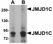 JMJD1C Antibody - Western blot of JMJD1C in human liver tissue lysate with JMJD1C antibody at (A) 1 and (B) 2 ug/ml. 