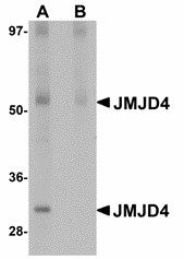 JMJD4 Antibody - Western blot of JMJD4 in human spleen tissue lysate with JMJD4 antibody at 1 ug/ml in (A) the absence and (B) the presence of blocking peptide. 