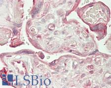 JMY Antibody - Human Placenta: Formalin-Fixed, Paraffin-Embedded (FFPE)