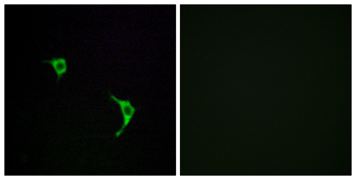 JNK1+2+3 Antibody - Immunofluorescence analysis of LOVO cells, using SAPK/JNK Antibody. The picture on the right is blocked with the synthesized peptide.
