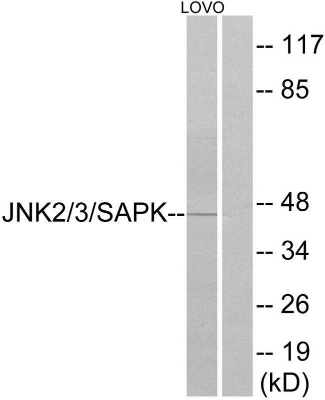 JNK1+2+3 Antibody - Western blot analysis of lysates from LOVO cells, using SAPK/JNK Antibody. The lane on the right is blocked with the synthesized peptide.