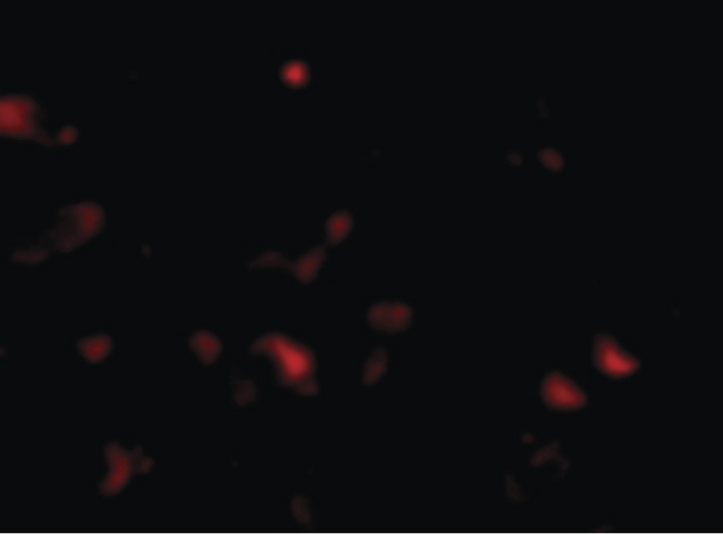 JPH3 Antibody - Immunofluorescence of JPH3 in Human Brain cells with JPH3 antibody at 20 ug/ml.