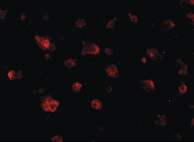 JPH3 Antibody - Immunofluorescence of JPH3 in human brain tissue with JPH3 antibody at 20 ug/ml.