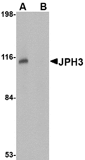 JPH3 Antibody - Western blot of JPH3 in Daudi cell lysate with JPH3 antibody at 1 ug/ml in (A) the absence and (B) the presence of blocking peptide.