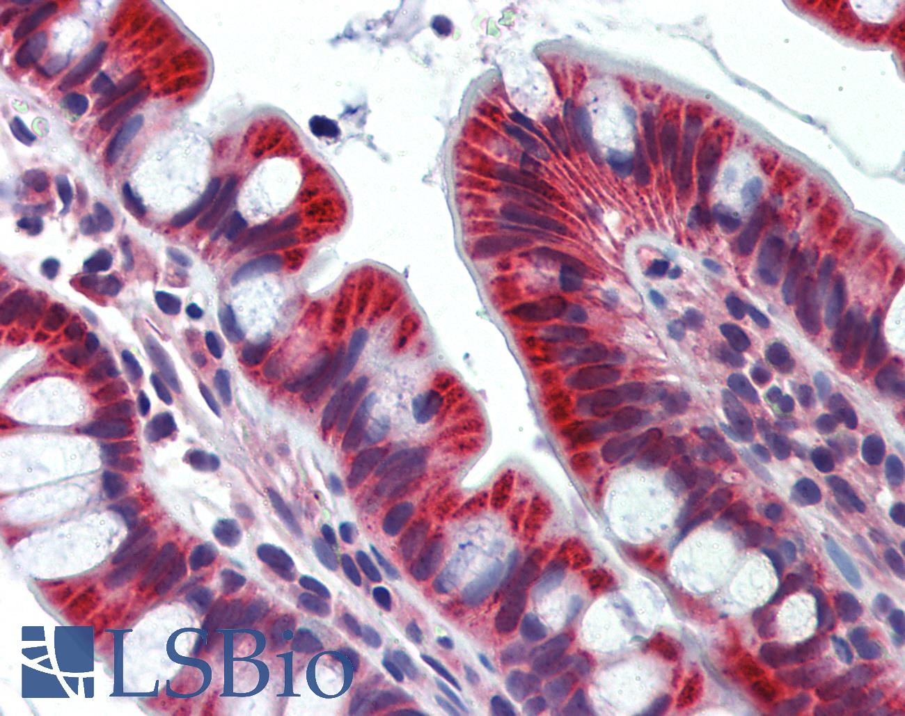 JPH4 Antibody - Anti-JPH4 antibody IHC of human small intestine. Immunohistochemistry of formalin-fixed, paraffin-embedded tissue after heat-induced antigen retrieval. Antibody concentration 5 ug/ml.