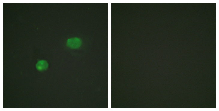 JUN / c-Jun Antibody - Immunofluorescence analysis of HeLa cells, using c-Jun Antibody. The picture on the right is blocked with the synthesized peptide.