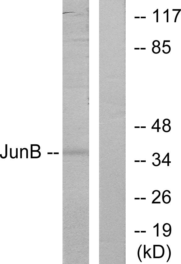 JUNB / JUN-B Antibody - Western blot analysis of lysates from HeLa cells, using JunB Antibody. The lane on the right is blocked with the synthesized peptide.