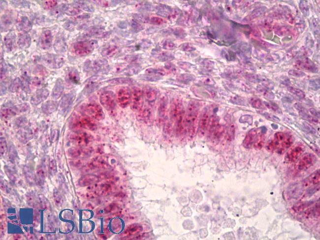 JUNB / JUN-B Antibody - Anti-JUNB antibody IHC of human uterus, endometrium. Immunohistochemistry of formalin-fixed, paraffin-embedded tissue after heat-induced antigen retrieval. Antibody dilution 1:100.