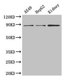 Junctin / ASPH Antibody - Western blot All lanes: ASPH antibody at 4 µg/ml Lane 1: Mouse lung tissue Lane 2: Mouse kidney tissue Lane 3: Mouse brain tissue Lane 4: Mouse thymus tissue Secondary Goat polyclonal to rabbit IgG at 1/10000 dilution Predicted band size: 86, 35, 26, 24, 34, 84, 30, 22, 29 kDa Observed band size: 86 kDa