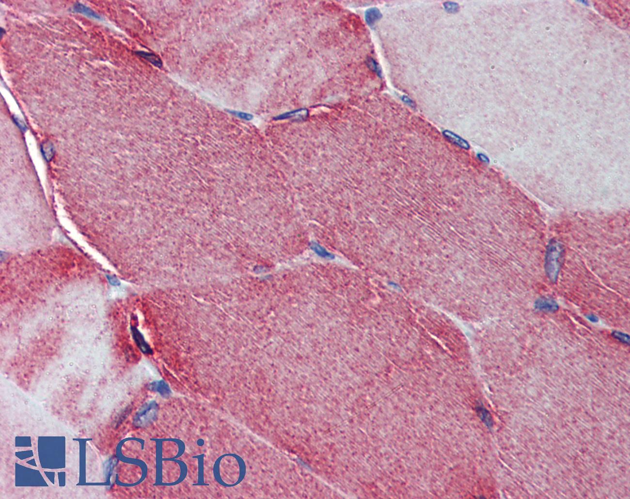 Junctophilin 2 / JPH2 Antibody - Anti-JPH2 antibody IHC of human skeletal muscle. Immunohistochemistry of formalin-fixed, paraffin-embedded tissue after heat-induced antigen retrieval. Antibody concentration 5 ug/ml.