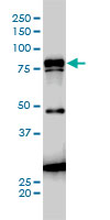 JUP/CTNNG/Junction Plakoglobin Antibody - JUP monoclonal antibody clone 1D5 Western blot of JUP expression in A-431.